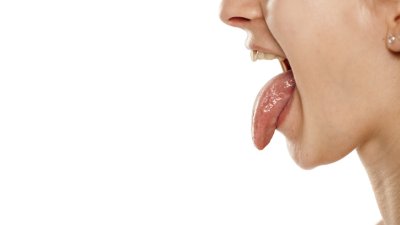 Study finds, losing fat in your tongue might recover sleep apnea