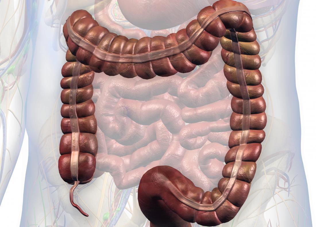 Signs of familial susceptibility to appendiceal cancer